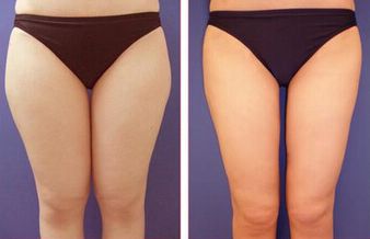 廣州看痘印哪家醫(yī)院好？細(xì)數(shù)廣州治療痘印最佳醫(yī)院！