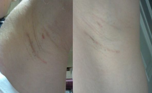 恩施地區(qū)有哪些信譽好的美容整形醫(yī)院？