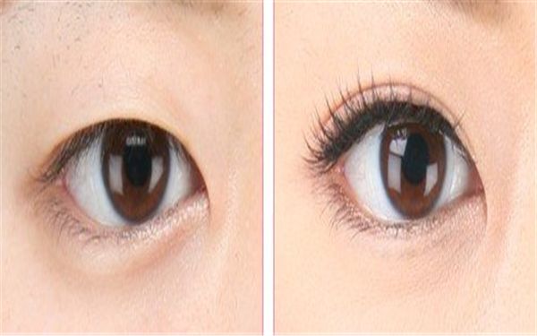 中國哪家醫(yī)院皮膚修復(fù)好？專家告訴你最靠譜的皮膚修復(fù)醫(yī)院有哪些