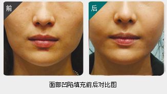 錦州整形美容醫(yī)院哪家靠譜？醫(yī)療技術如何？