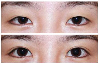 2023肇慶E光腿部脫毛專家排名榜前10名(聶金漢、司義湘、閆運(yùn)濤去過都說好！)