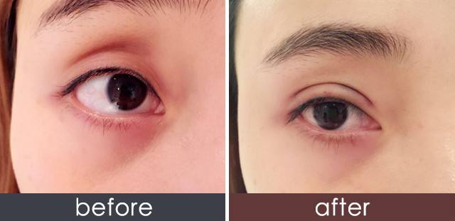 2023馬鞍山鐳射祛斑醫(yī)生前十位排行榜(石京頤、石京頤、周曉晶排名不分先后，一睹為快~)