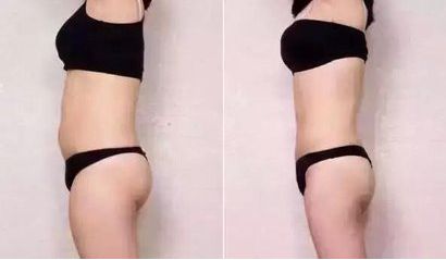 太原哪家醫(yī)院祛痘效果好？專家推薦的太原祛痘醫(yī)院排行榜