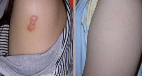 長沙整形哪家美容醫(yī)院好？專家揭秘長沙市頂級整形醫(yī)院排行榜！