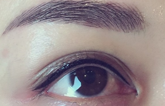 北京優(yōu)秀雙眼皮修復醫(yī)生推薦，實力專家排行榜公開！這五位專業(yè)醫(yī)師技能高超！有真實案例可供參考