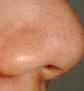 2023重慶填充動(dòng)態(tài)細(xì)紋凹陷排行top10強(qiáng)的醫(yī)生(鄧穎&nbsp;、張代祿、田凱私立醫(yī)美有看頭)