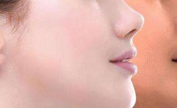 2023昆山玻尿酸豐上唇珠醫(yī)生在榜名單前10位(張金輝、陳曉偉、許軍愛鎖定前三，贏麻了！)