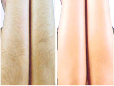 2023石家莊保妥適肉毒素注射前十強專家(任啟瑞、宋子軍、鄭鳳蘭技術(shù)、設(shè)備領(lǐng)先)