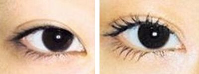 深圳祛痘印痘疤那家醫(yī)院靠譜且經(jīng)濟(jì)實(shí)惠？