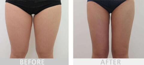 福州五位整形醫(yī)生名單首發(fā)，王彪、王美水等幫你塑造完美五官！