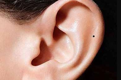 天津治療黃褐斑哪家醫(yī)院好？專家點(diǎn)評及用戶真實(shí)評價(jià)！