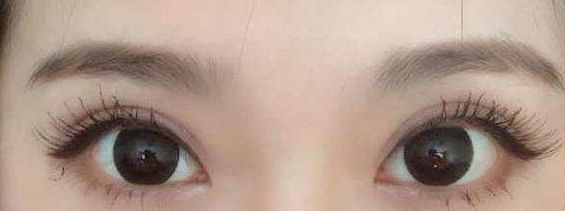 西安哪家醫(yī)院的激光祛痘項(xiàng)目質(zhì)量好？