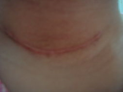 2023臨汾眼鼻精細化精雕專家排行前10名(肖建華、李奕得、洪政秀不看后悔)