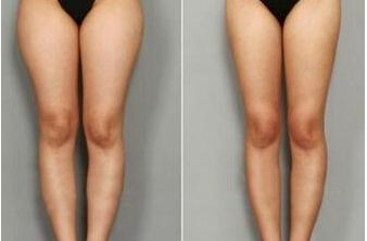 南寧皮膚外科醫(yī)院排名哪家醫(yī)院皮膚外科好？