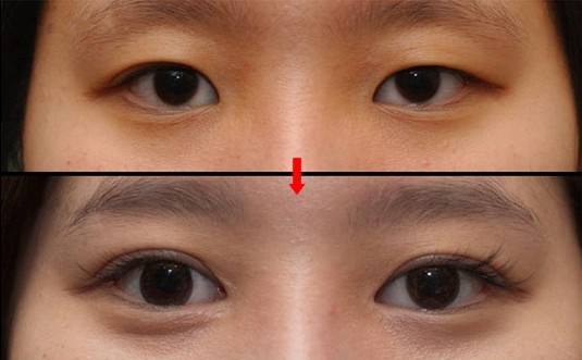 2023佛山大腿吸脂瘦腿專家評分前10強(謝漢平、曹碧浪、佛山曙光金子劉云忠龍頭地位穩(wěn)固)