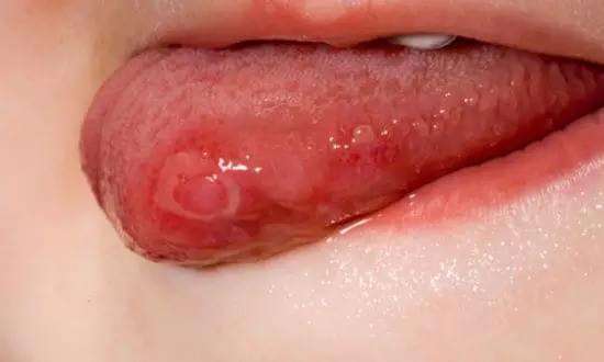 2023佛山肉毒素注射法令紋權(quán)威專家排名榜前10強(qiáng)(王燕、劉永波、樸鐘洙（韓）這些實(shí)力專家供你選擇)