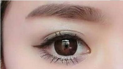 長沙哪位醫(yī)生擅長解燦割雙眼皮技術(shù)？