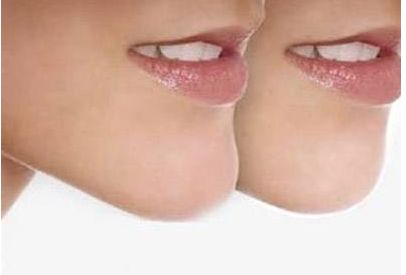 嘉興割雙皮哪家醫(yī)院好？為您推薦嘉興市內(nèi)專業(yè)割雙皮醫(yī)院排行榜