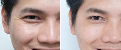 南京哪家整形醫(yī)院隆鼻效果最好？