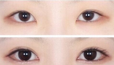 濟南哪家醫(yī)院的豐胸手術(shù)效果最好？