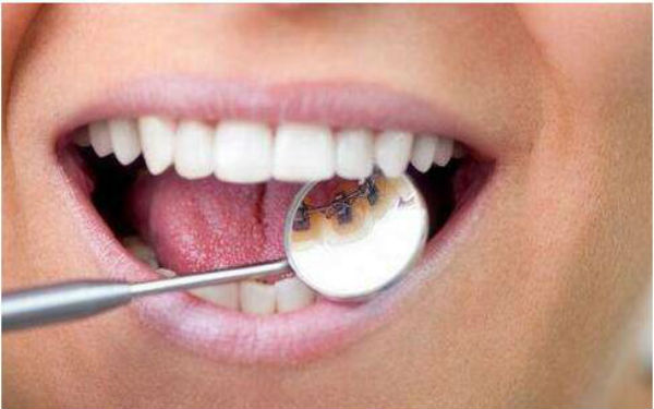 2023杭州純手工負(fù)壓吸脂精雕術(shù)排行前10位醫(yī)生(賈明、桑宇奇、周慎健測(cè)評(píng)榜追擊不踩雷)