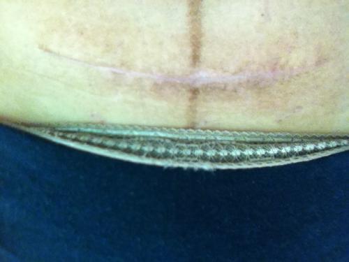 2023武漢水光針美容前十名專家(張雙洲、羅南生、肖緒技術(shù)、口碑一目了然)