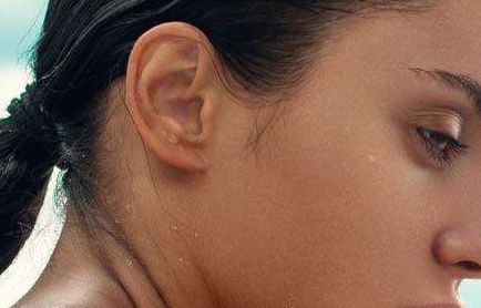 福州胎記?？漆t(yī)院哪家好？解析福州市胎記治療醫(yī)院排名