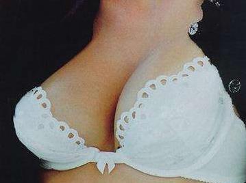 2023深圳物理祛除口周紋排名前十名的醫(yī)生(范開防、吳曉燕、李明等公立私立媲美)