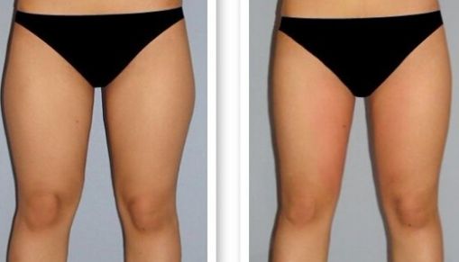 長(zhǎng)沙哪家激光點(diǎn)痣醫(yī)院口碑好？