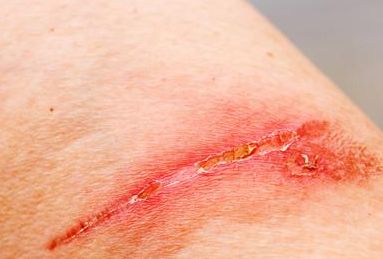 重慶去眼袋醫(yī)院哪家好？專業(yè)醫(yī)生推薦最佳醫(yī)院解決眼袋問題