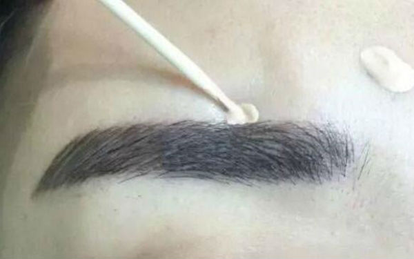 徐威強顎下角整形術：讓您輕松擁有自然平滑線條