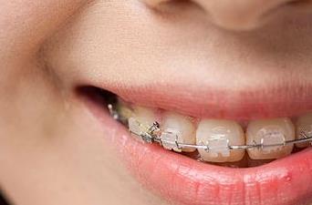 2023濟(jì)寧面部皺紋除皺針權(quán)威醫(yī)生榜單前10位(李春燕、朱汝崗、劉郭專注技術(shù)提升)