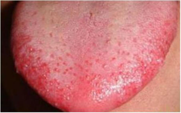 2023蘭州多維分層定向吸脂術(shù)排行榜前10名專家(劉先超、魏翠萍、陳誠技術(shù)實(shí)力尤其突出！)