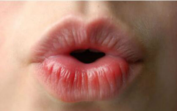 2023成都抬頭紋剝離大型醫(yī)生(董灜、周斌、劉國權(quán)當(dāng)屬當(dāng)?shù)孛麣飧?