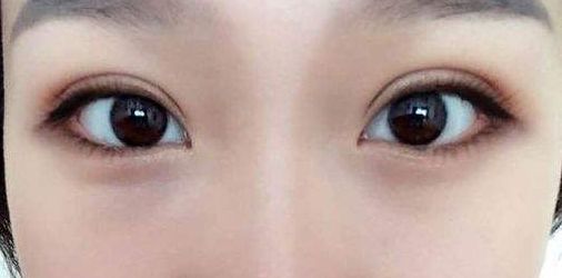 永州地區(qū)哪家正規(guī)整形醫(yī)院好？