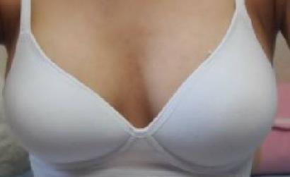 2023太原內(nèi)窺鏡除皺去妊娠紋醫(yī)生口碑榜前十強(qiáng)(高燕、李竹英、陳衛(wèi)玲口碑技術(shù)絕絕子！)