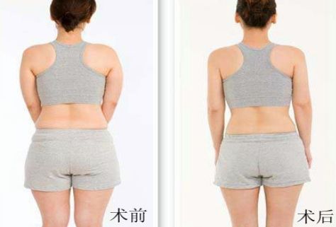 杭州哪家祛痘醫(yī)院好？綜合評(píng)測(cè)幫你選擇！