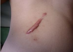 南寧激光美容中心哪家好？探索最佳的南寧激光美容中心排名及用戶口碑