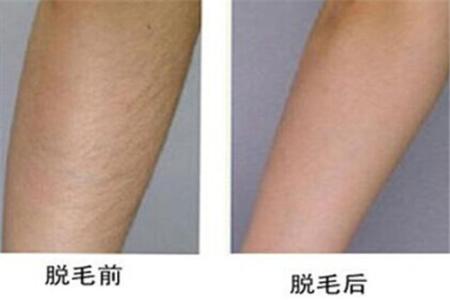 2023廣州激光治療酒渣鼻專家在榜名單前10位(梁曉姻、鄭載浩、盧剛高居榜首)