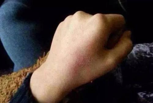 2023南京注射除細紋排名十強醫(yī)生(吳國平、亓發(fā)芝、張廣宇技術(shù)很權(quán)威)