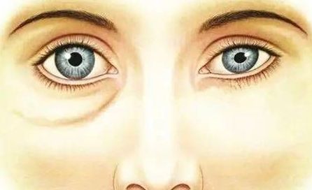 酒糟鼻南寧哪家醫(yī)院好？專家推薦南寧哪家醫(yī)院治療酒糟鼻效果最好