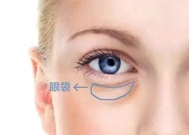 蘇州哪家醫(yī)院治療黃褐斑效果好？