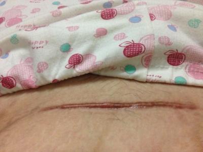 2023威海無痛隆鼻手術(shù)榜上top10強(qiáng)專家(荊煜林、葛杰、王志偉讓你變美更安心！)