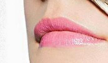 2023秦皇島精雕祛眼周紋推薦TOP10強醫(yī)生(岳紅利、劉運濤、王二偉私立推薦)