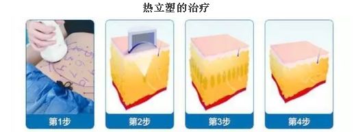 上海臉部祛斑哪家醫(yī)院好？揭秘上海市最受歡迎臉部祛斑醫(yī)院排行榜