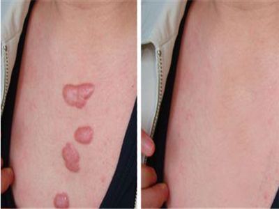 云南哪家整形醫(yī)院好？找個專業(yè)的才放心！