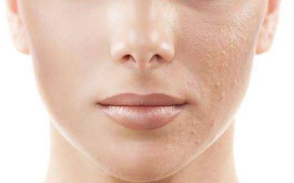 成都華顏隆鼻價(jià)格高嗎？坐診醫(yī)生介紹及收費(fèi)情況詳解