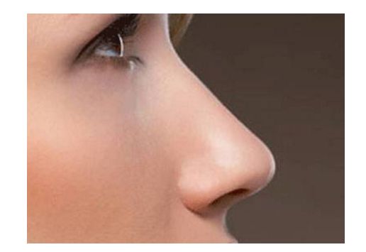 昆明狐臭求治，哪家醫(yī)院治療效果好？