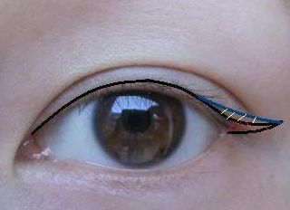 2023昆明隆胸整形哪家醫(yī)院好？專家推薦與真實案例一覽