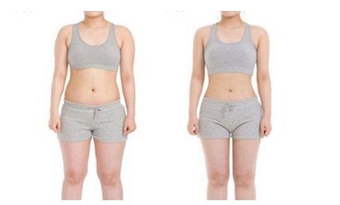 上海哪家醫(yī)院能有效去除妊娠紋，讓肌膚重新恢復(fù)緊致？